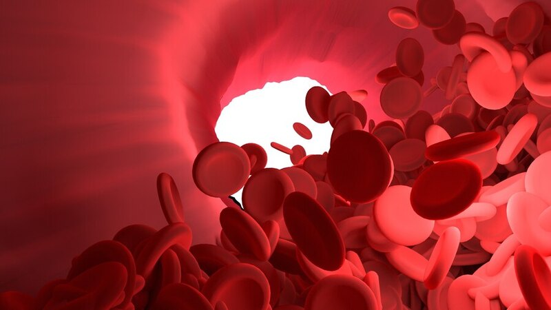 Hồng cầu tăng gây ra tình trạng tắc nghẽn mạch máu khiến người bệnh bị đột quỵ