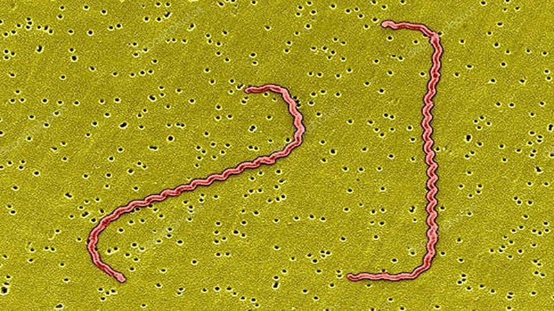 Xoắn khuẩn Leptospira thường trú ngụ tại ao hồ, mương, bùn lầy, nước mưa... 