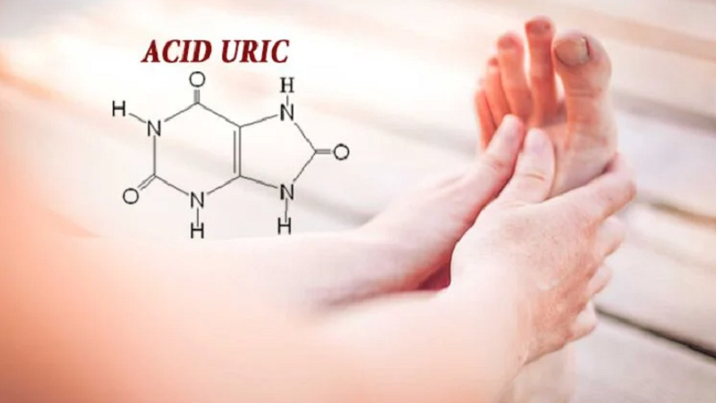 Tăng chỉ số acid uric trong máu là nguyên nhân gây nên các triệu chứng của bệnh gout