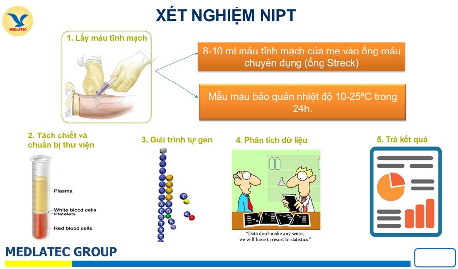 Xét nghiệm NIPT là một biện pháp sàng lọc trước sinh hiệu quả giúp phát hiện sớm các bất thường nhiễm sắc thể như Hội chứng Turner