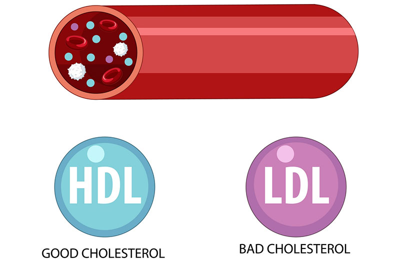 Lecithin giúp kiểm soát, làm giảm lượng Cholesterol xấu LDL gây hại cho sức khỏe