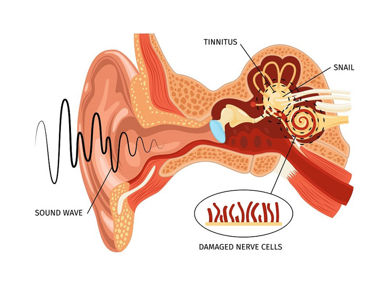 Mô tả khái quát cấu trúc của tai