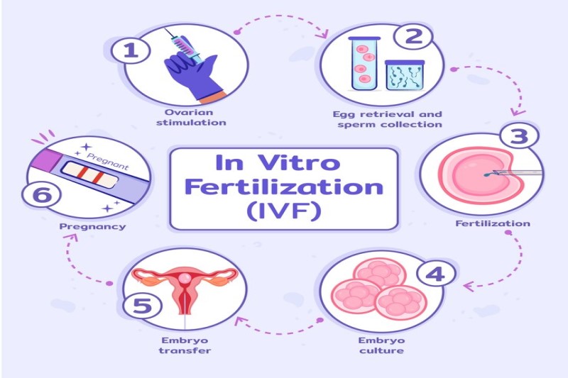 IVF mang lại cơ hội có con cho các cặp vợ chồng vô sinh thứ phát