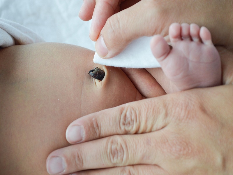  Em bé rụng rốn nhưng vẫn chảy máu : Nguyên nhân và cách xử lý hiệu quả