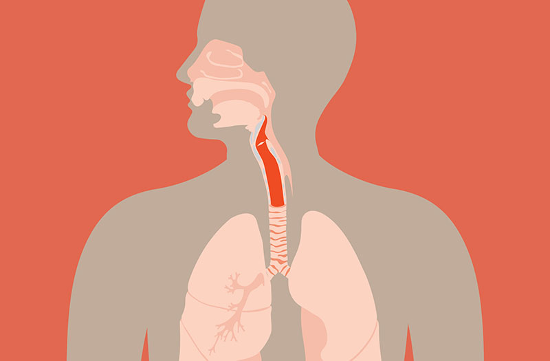 Các triệu chứng đau họng và khó nuốt có thể là dấu hiệu của ung thư thanh quản?
