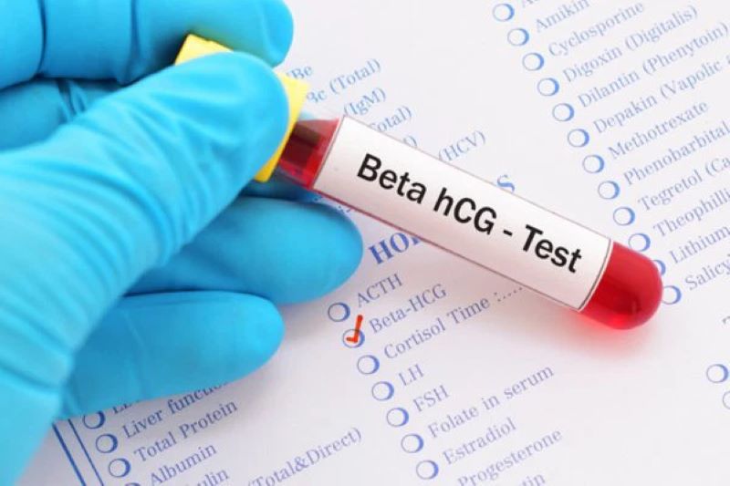 Beta hCG là xét nghiệm phổ biến để chẩn đoán phụ nữ có thai hay không