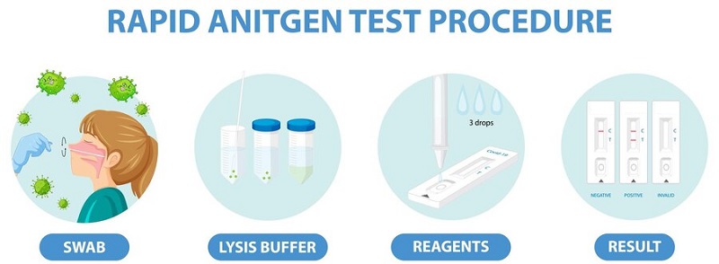 Mô phỏng quy trình test cúm A bằng phương pháp test nhanh 