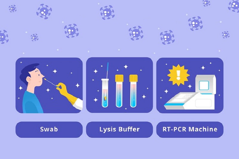 Test cúm A bằng phương pháp RT-PCR