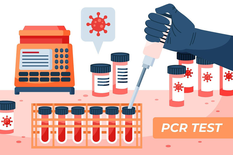 Xét nghiệm RT-PCR giúp chẩn đoán cúm B