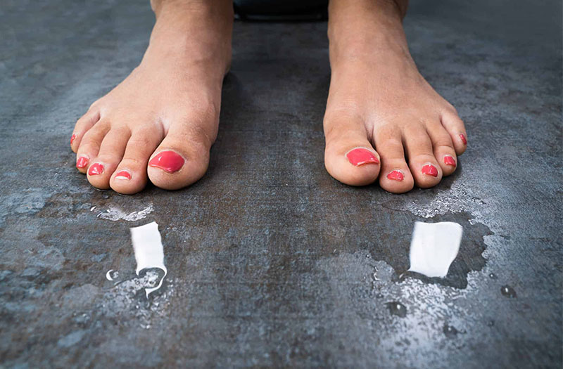 Môi trường ngoại vi có ảnh hưởng đến tình trạng mồ hôi tay chân không?
