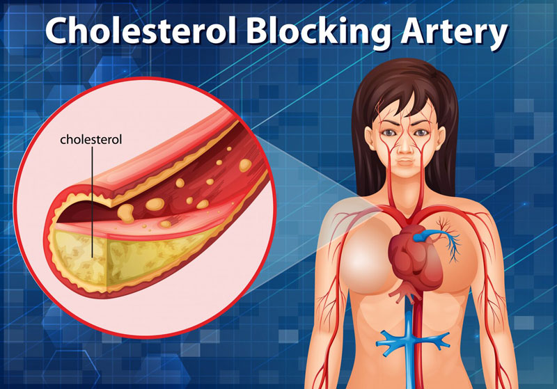 Thường xuyên dùng ớt chuông giúp giảm cholesterol xấu trong máu