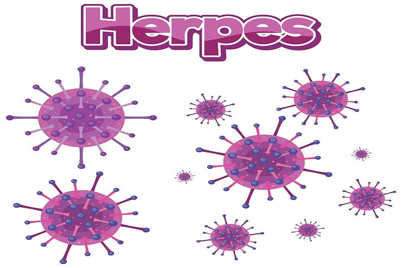 Virus herpes có thể gây nên viêm não cấp ở người trưởng thành