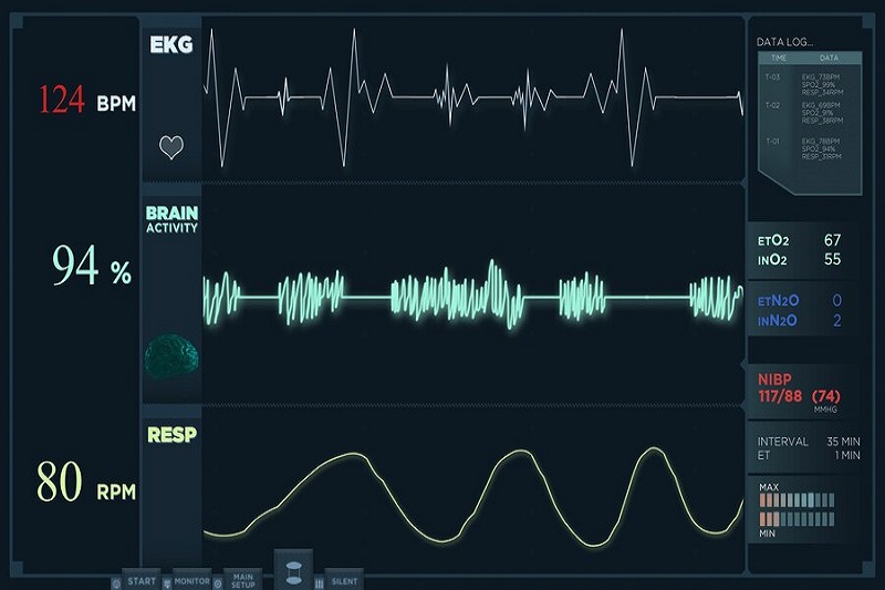 Điện tâm đồ ECG góp phần chẩn đoán suy tim nặng