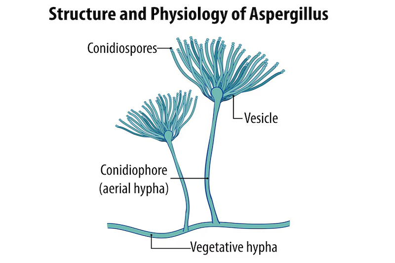 Aspergillus - một trong những tác nhân gây nên nấm mũi xoang