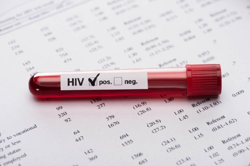 Xét nghiệm HIV sớm là cần thiết để điều trị tích cực, tránh lây nhiễm cho cộng đồng