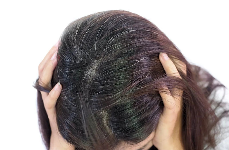 Cách trị tóc bạc sớm tại nhà dứt điểm nhanh và hiệu quả nhất