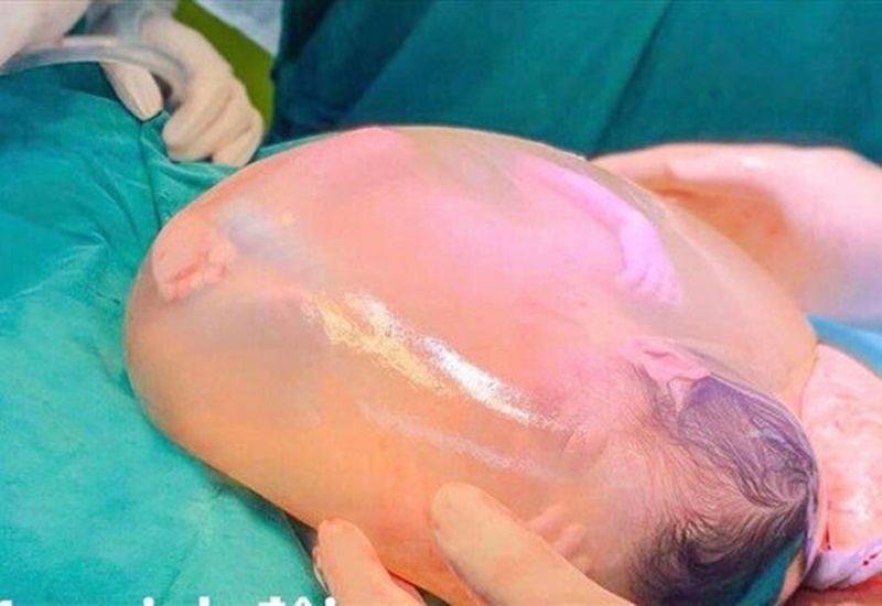 Số Mệnh Người Đẻ Bọc Điều - Khám Phá Ý Nghĩa Tâm Linh và Những Điều Thú Vị