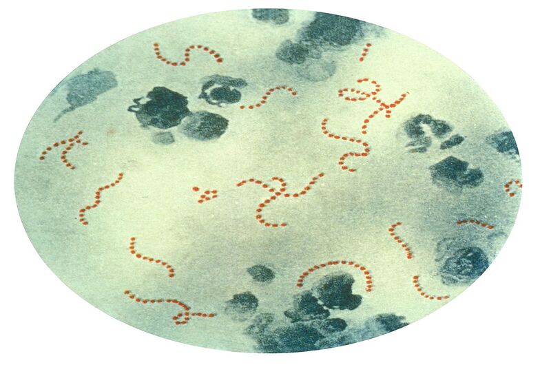 Streptococcus pyogenes là một trong các nguyên nhân gây bệnh