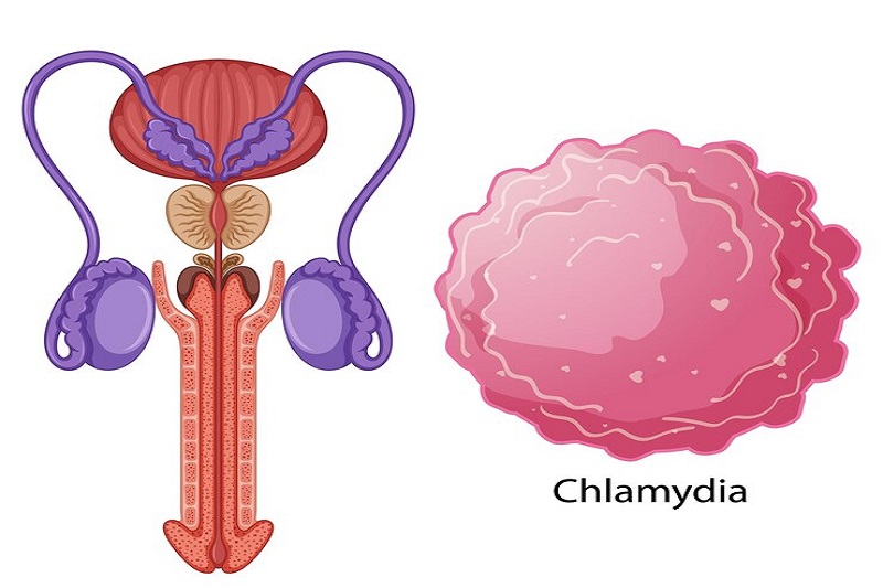 Nhiễm trùng cơ quan sinh dục có thể khiến nam giới bị suy tinh hoàn