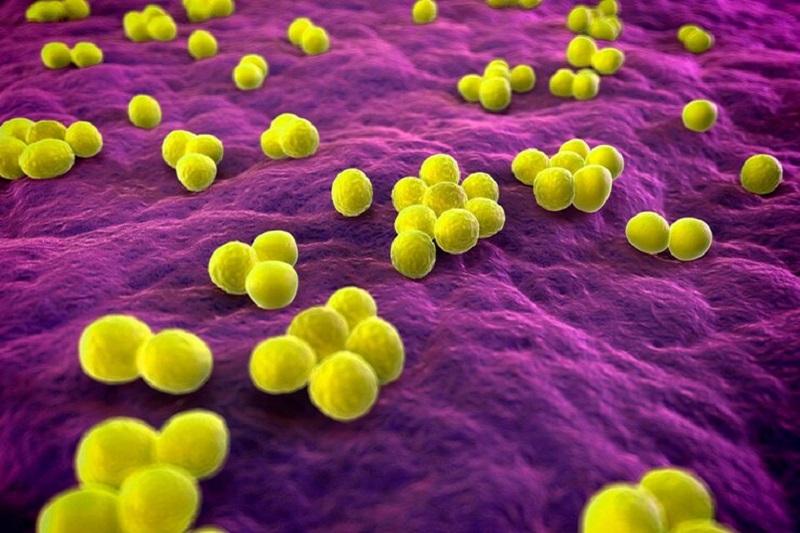 Vi khuẩn Staphylococcus aureus có thể gây viêm tuyến nước bọt