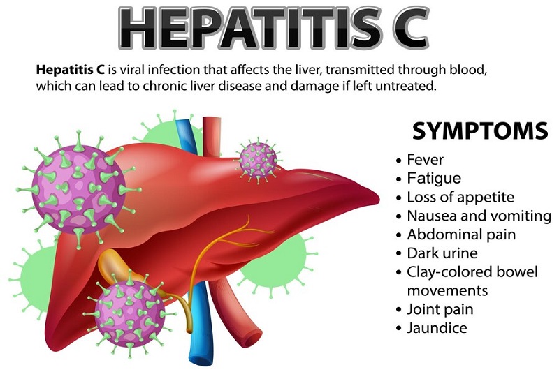 Virus HCV tấn công gan và gây bệnh viêm gan C