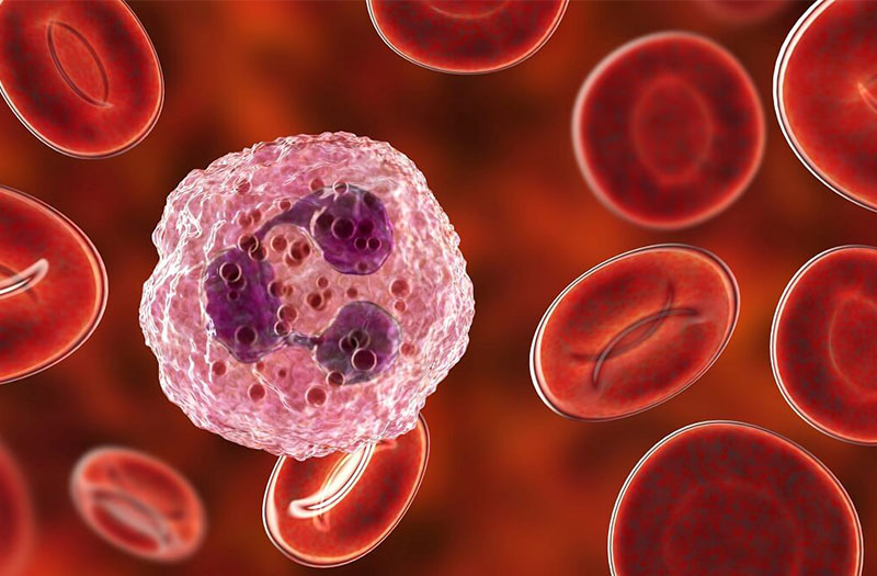 Rối loạn bạch cầu có thể có liên quan đến bệnh ung thư máu hay khối u máu?