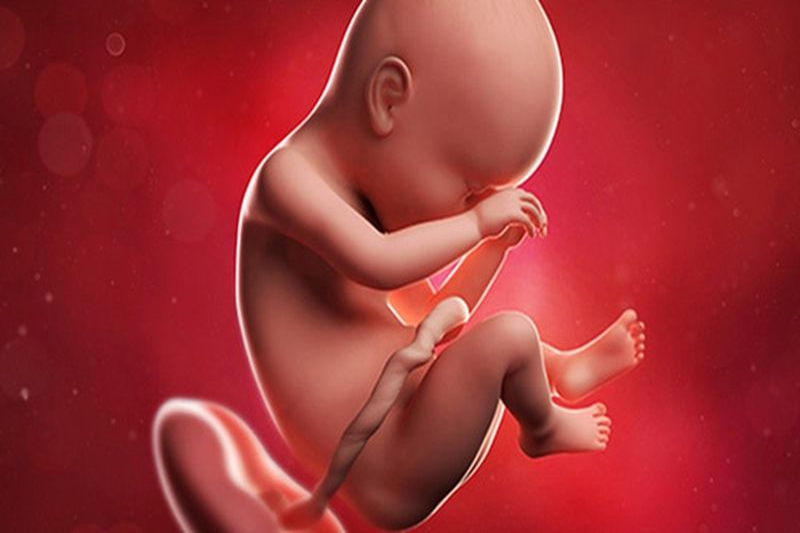 Đa u mô thừa đường mật liên quan đến bất thường đường mật từ trong bào thai