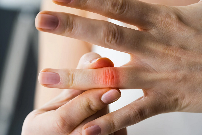 Đau ngón tay phần lớn có thể tự khỏi, nhưng nếu kéo dài người bệnh cần đi gặp bác sĩ.