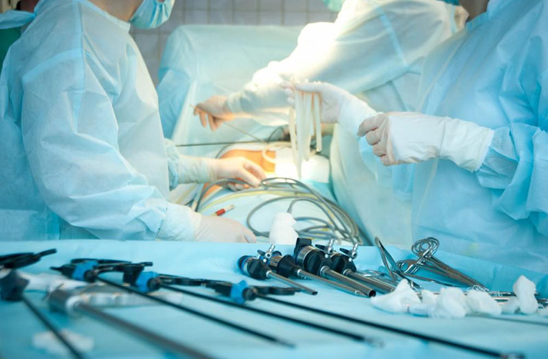 Phẫu thuật mổ túi mật nội soi có ưu điểm gì so với phẫu thuật truyền thống?
