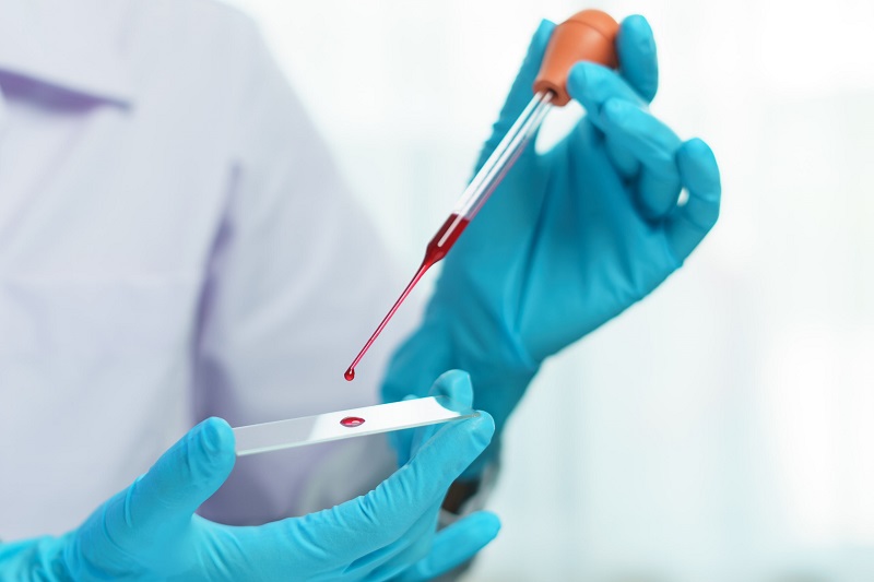  Xét nghiệm máu để biết thiếu chất gì - Tìm hiểu thêm về quy trình và lợi ích