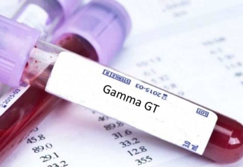 Xét nghiệm sinh hóa GGT giúp đánh giá chức năng gan mật