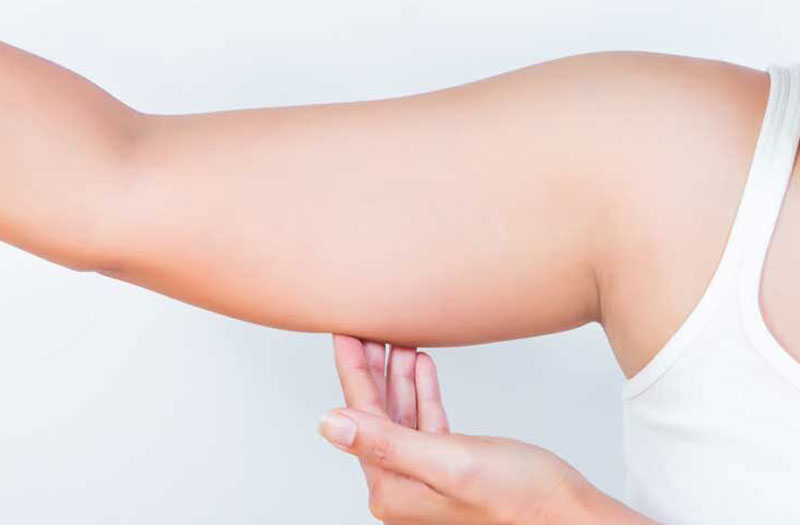 Làm thế nào để giảm mỡ bắp tay hiệu quả?