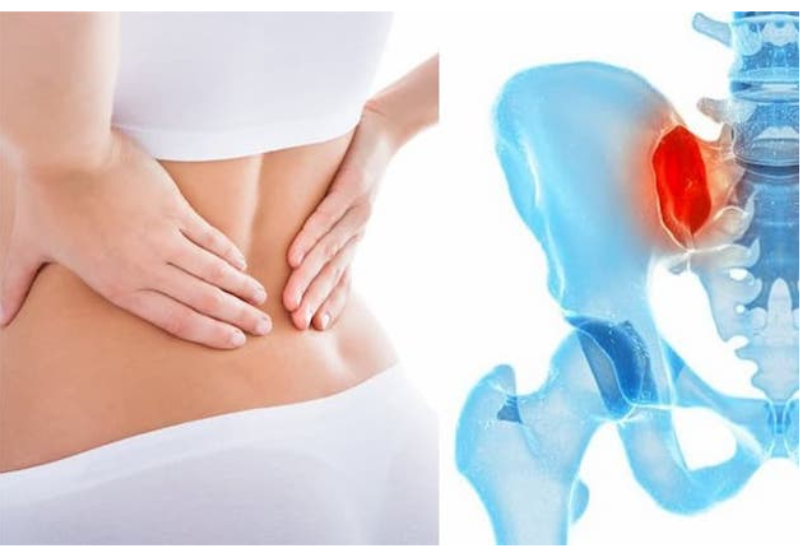 Đau vùng thắt lưng dưới là dấu hiệu đặc trưng của viêm khớp cùng chậu.