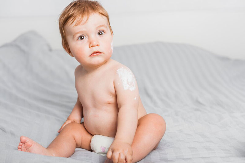 Bệnh ghẻ ngứa ở trẻ em gây ra bởi ký sinh trùng Sarcoptes scabiei var hominis