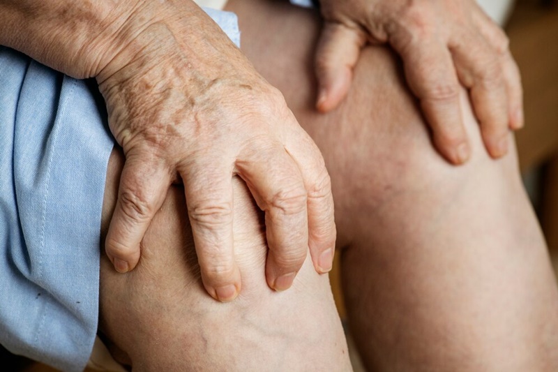 Suy giãn tĩnh mạch chi dưới khiến bạn đau nhức chân