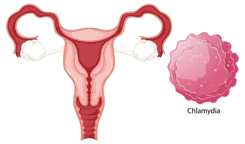 Chlamydia rất nguy hiểm đối với phụ nữ mang thai