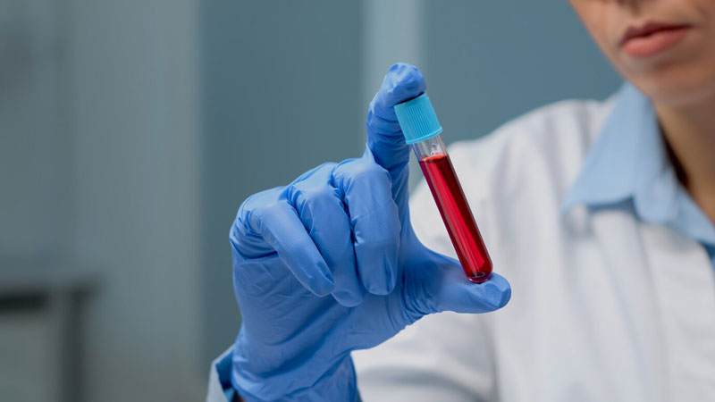 Xét nghiệm PCR giúp xác định nhiều bệnh lý như lậu, Chlamydia