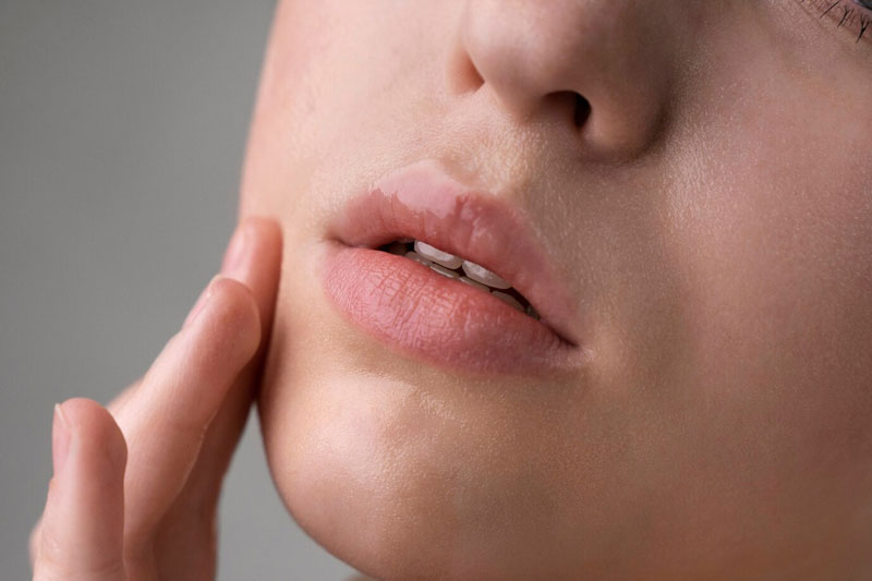 Người bệnh nên bôi thuốc điều trị theo đúng hướng dẫn và chỉ định từ bác sĩ 