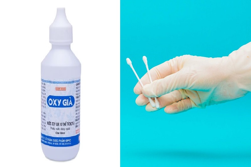 Tự thực hiện cách lấy ráy tai khô cứng bằng oxy già tại nhà tiềm ẩn rủi ro tổn thương tai