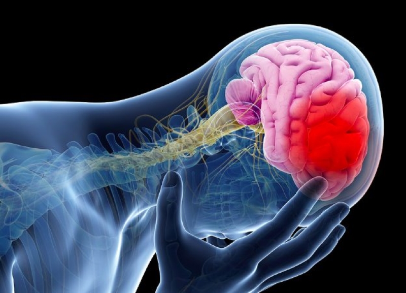 Nhồi máu não có thể gây ra những biến chứng nghiêm trọng nếu không được phát hiện và xử trí kịp thời 