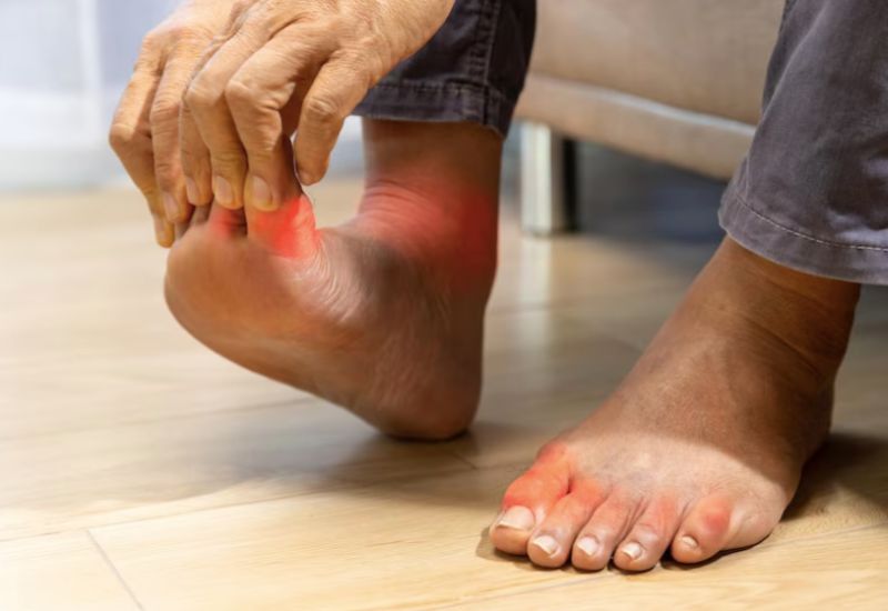 Có nhiều nguyên nhân khác nhau dẫn đến tình trạng sưng khớp ngón chân cái