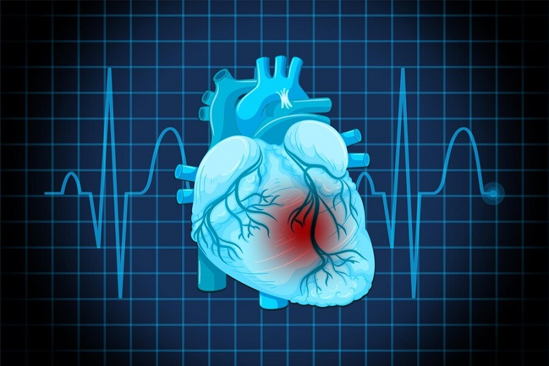 Tăng chỉ số Triglyceride khiến người bệnh có nguy cơ gặp phải bệnh lý tim mạch nguy hiểm