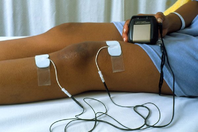 Liệu pháp dùng sóng âm trị liệu cường độ thấp có thể giúp giảm đau đùi dị cảm.