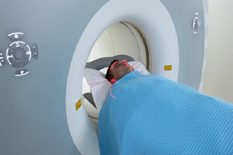 Chụp MRI tiêm thuốc tương phản là tiêu chuẩn vàng để hỗ trợ chẩn đoán viêm thần kinh thị.