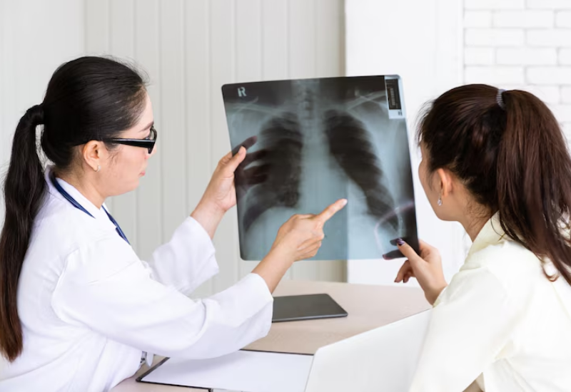 “Ung thư phổi giai đoạn 2 có chữa được không?” là câu hỏi không ít người thắc mắc