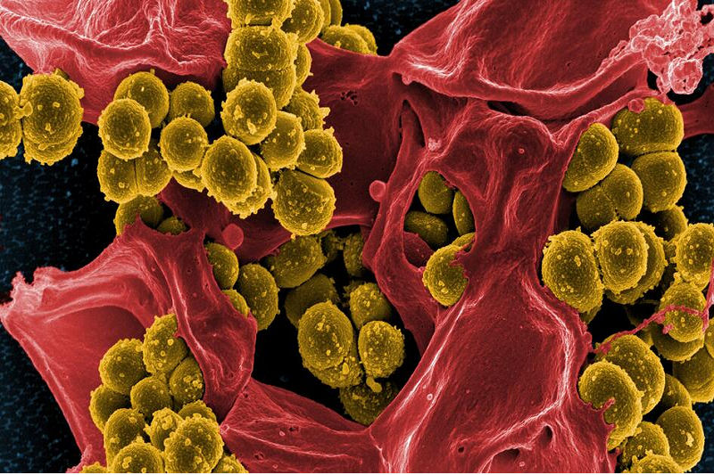 Staphylococcus aureus là vi khuẩn thường xâm nhập vào tuyến nhờn của mắt gây nhiễm khuẩn. 