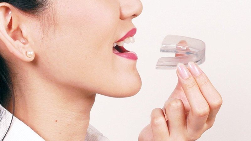Đeo máng chống niềng răng theo đúng hướng dẫn 