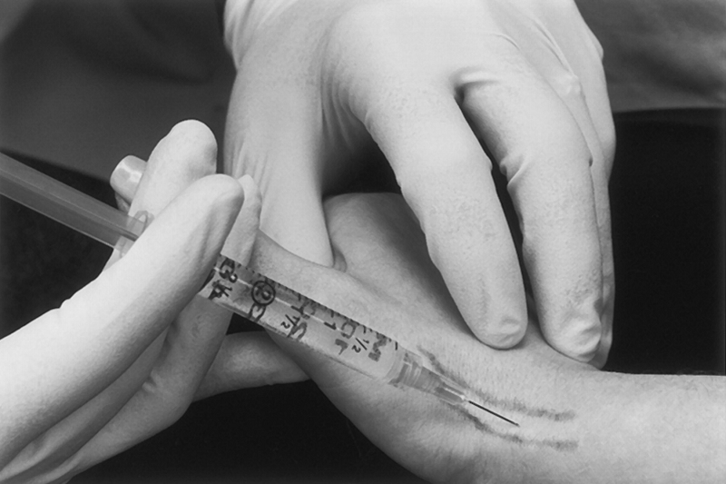 Tiêm corticosteroid là phương pháp được đánh giá rất hiệu quả, giúp giảm viêm bao gân và cắt cơn đau nhanh chóng.