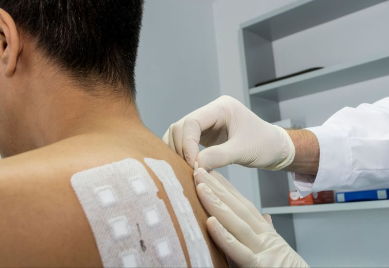 Nếu viêm da tiếp xúc ánh sáng có biểu hiện tái đi tái lại, không rõ nguyên nhân, bác sĩ da liễu có thể chỉ định test ánh sáng