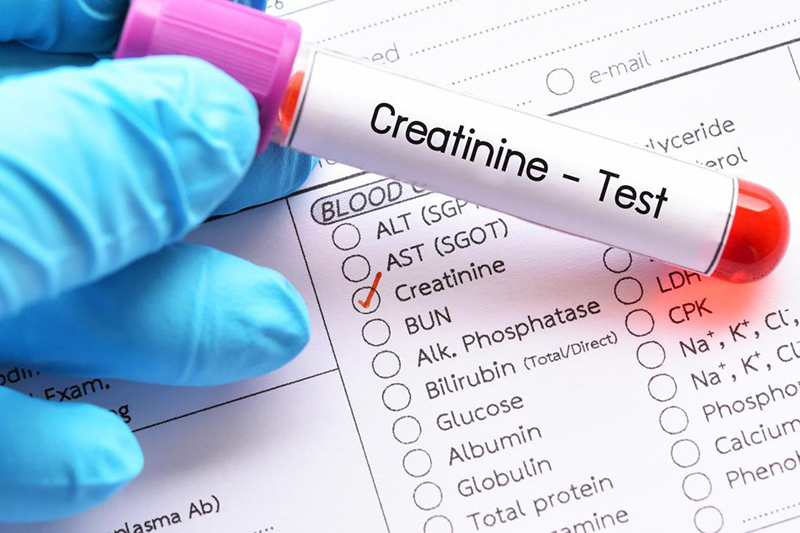 Creatinine huyết thanh là một trong những chỉ số xét nghiệm suy thận quan trọng 